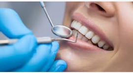 人們洗牙對牙齒認識的誤區有哪些