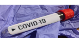Odwołanie treningów - COVID-19