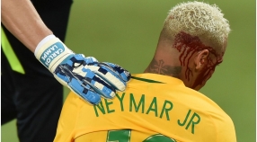 Neymar lämnade blodig i storseger