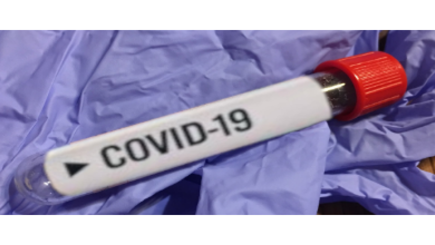 Odwołanie treningów - COVID-19